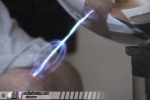 Spark jumps to demonstrator's arm